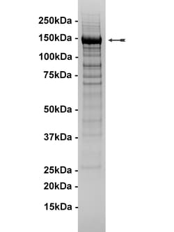 Eurofins DiscoverX PI3K-C2 Protein 10 &mu;g | Buy Online | Eurofins DiscoverX | Fisher Scientific